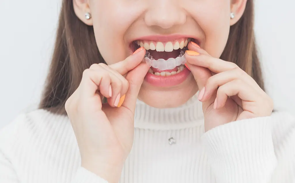 Braces and Halloween Candy are easy to manage if you stick to the rules.